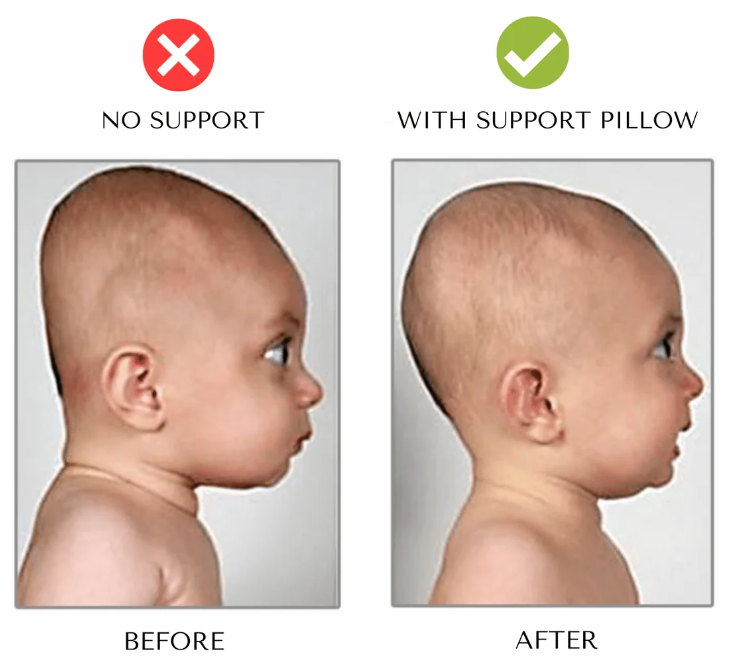 Baby Neck-Support Pillow